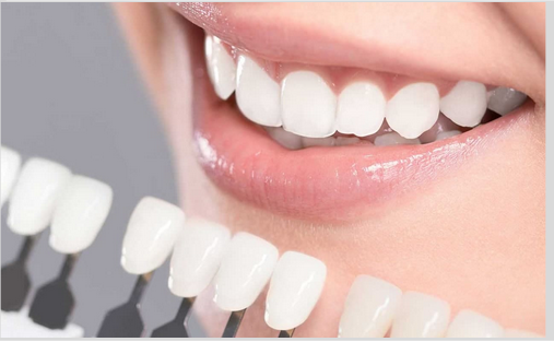 Why In-office Whitening Is More Effective Than At-Home Whitening?