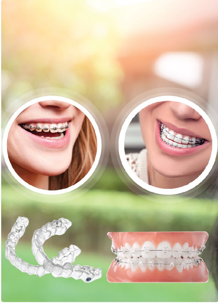 ORTHODONTIC TREATMENT