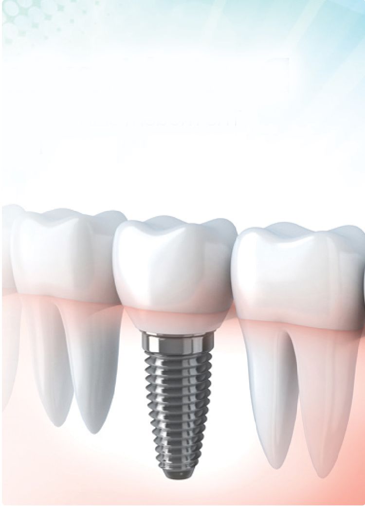 IMPLANT, EXTRACTION AND SURGERY