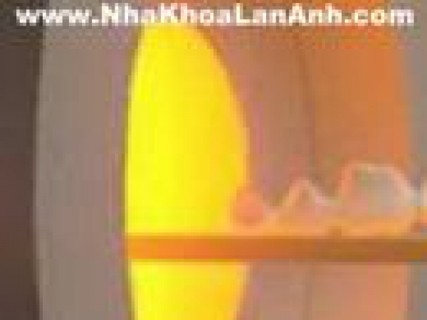 Zirconium - Cercon smart ceramic