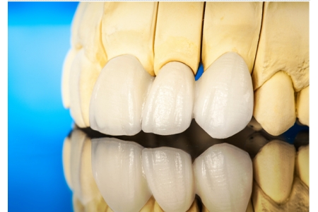 What factors does the durability of porcelain restoration depend on?