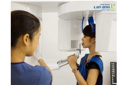 What Should You Pay Attention to When You Have Implant Placement?