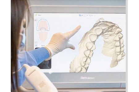 What is Invisalign Smileview Simulator?