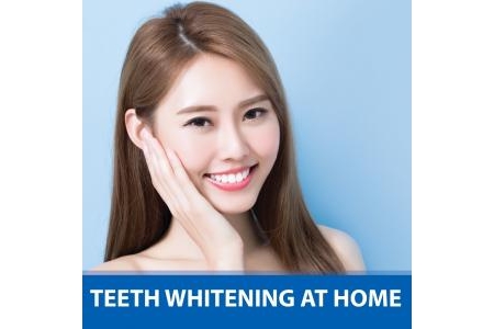 Whitening at home